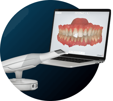 3D-пломбирование зубных каналов 