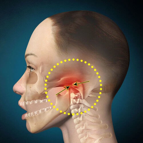 Изображение - Височно челюстной сустав лечение boli-pri-jevanii
