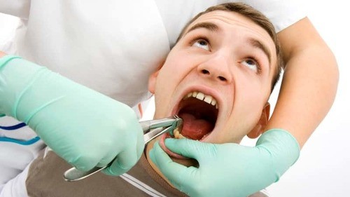Удаление зуба у пациента