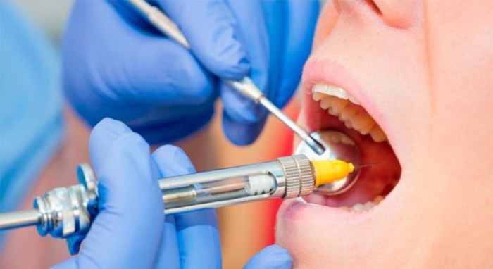 Лечение зубов и десен