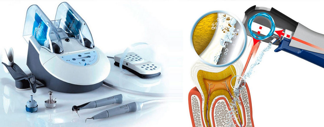 Принцип чистки зубов и лечения десен аппаратом Vector