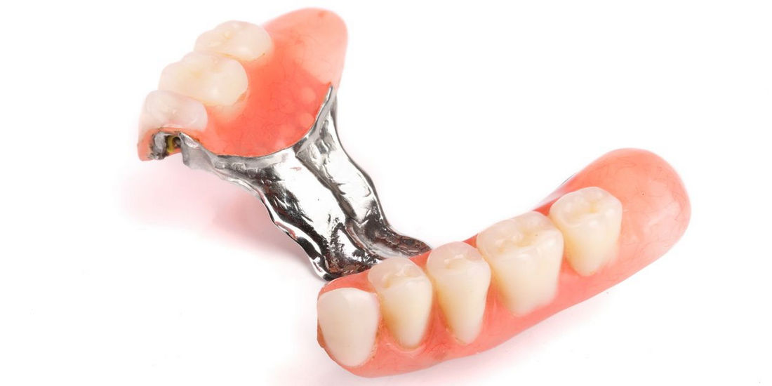 Особенности протезирования жевательных зубов